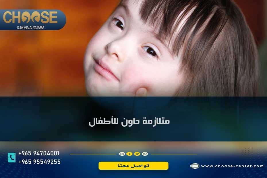 متلازمة داون